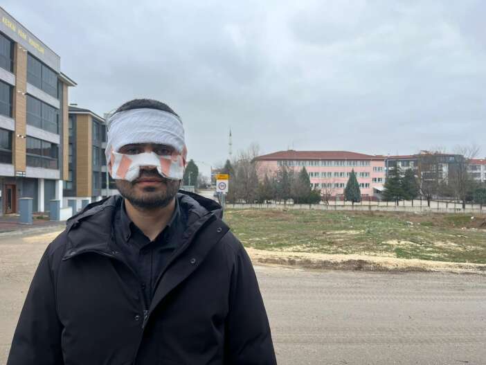 lisede-sok-iddia-rehber-ogretmen-fizikcinin-yuzunu-kaynar-cayla-yakti