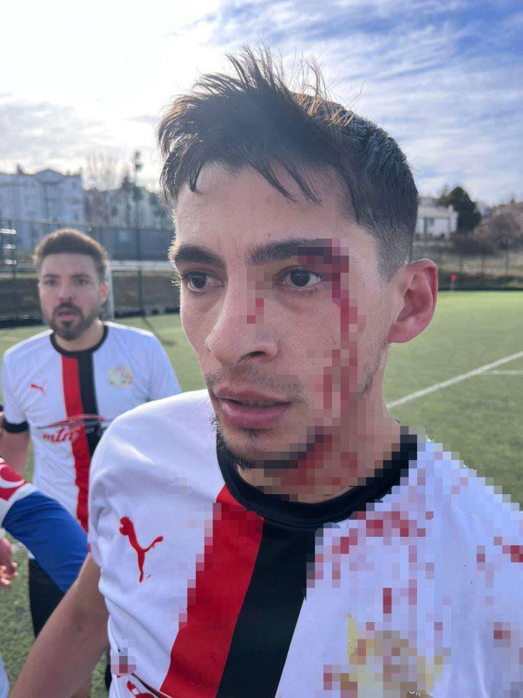 macin-bitis-duduguyle-saha-karisti-3-futbolcu-yaralandi