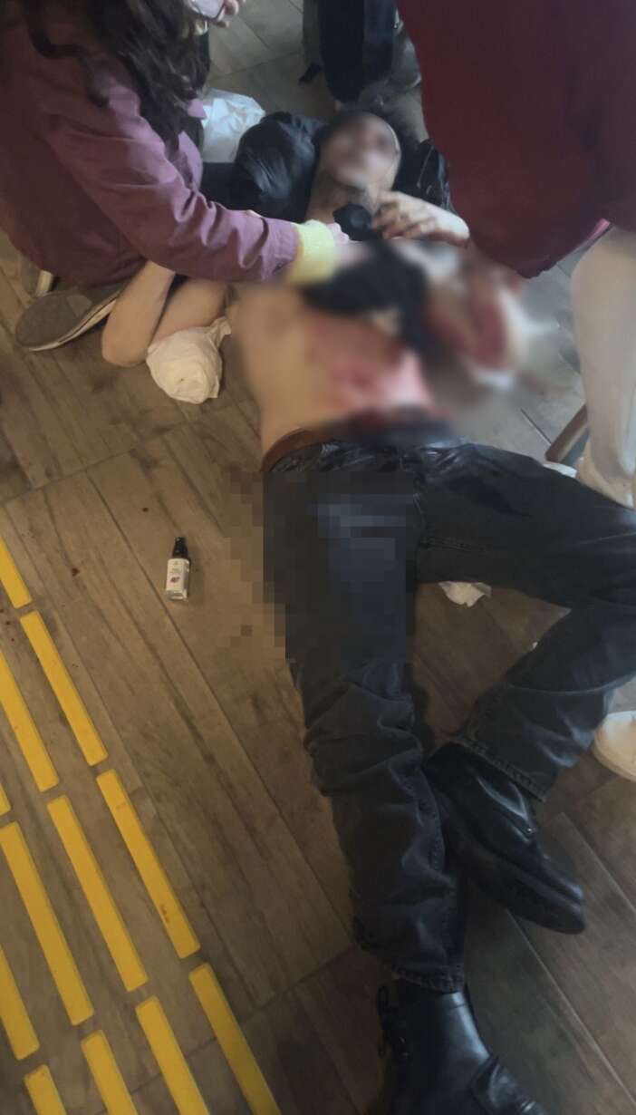 odev-kavgasi-kanli-bitti-universiteli-genc-gogsunden-bicaklandi