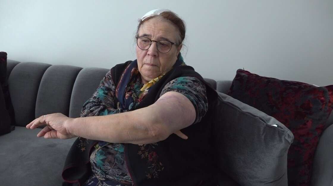 gozu-donmus-komsu-yasli-cifti-sokak-ortasinda-darp-etti