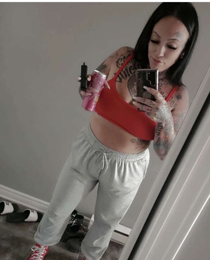 35-yasindaki-kadin-estetik-kurbani-oldu-ameliyatin-ardindan-oldu