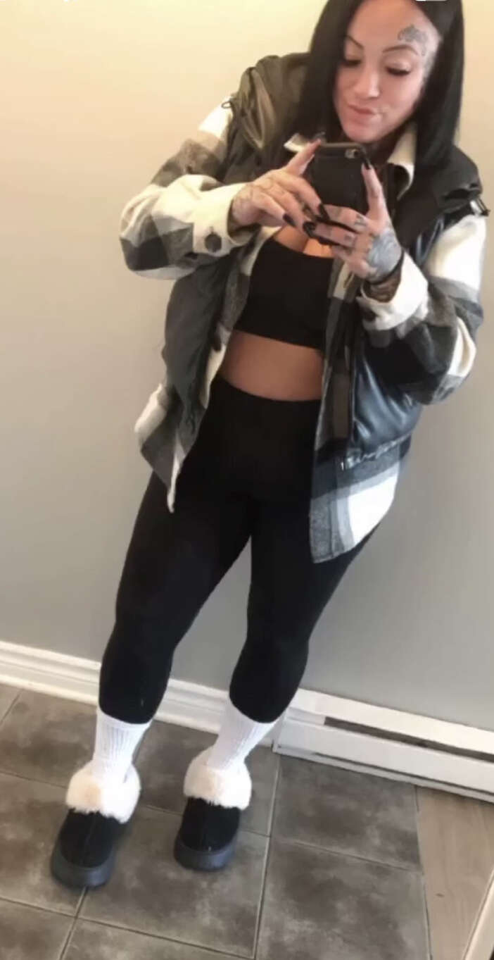 35-yasindaki-kadin-estetik-kurbani-oldu-ameliyatin-ardindan-oldu