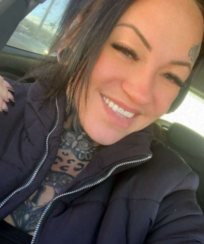 35-yasindaki-kadin-estetik-kurbani-oldu-ameliyatin-ardindan-oldu