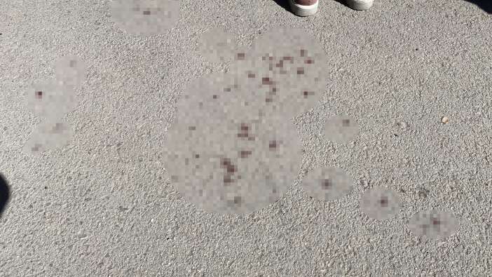 pazarda-sopali-kavga-3-kisi-yaralandi