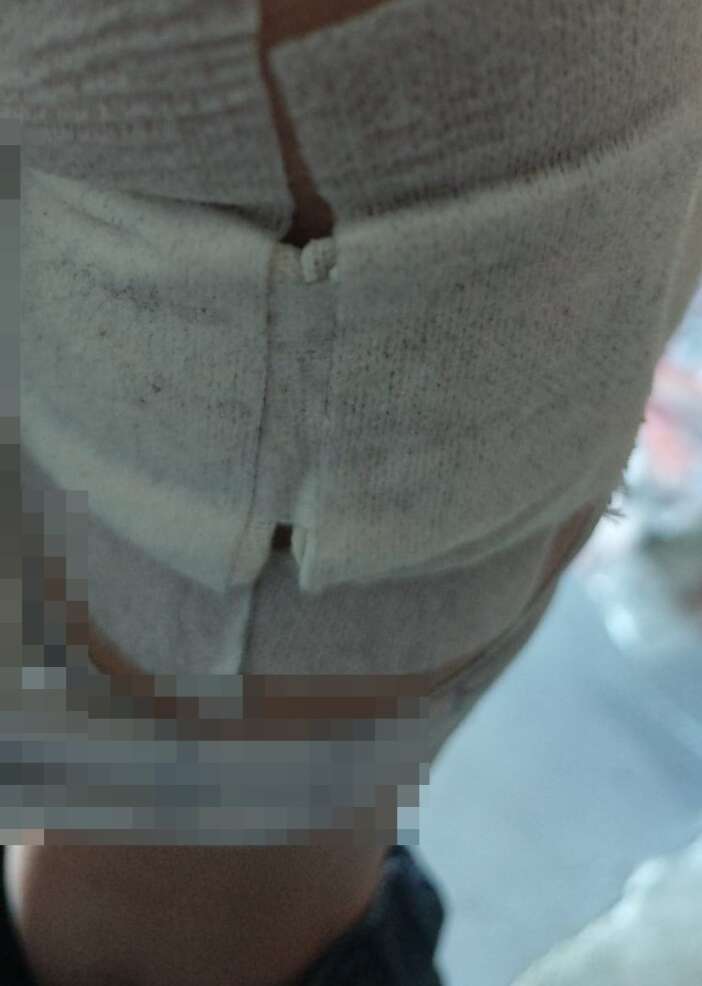 7-yasindaki-cocuga-kopek-saldirdi