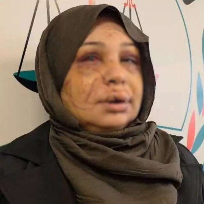 polis-memuru-esinin-yuzunu-jiletle-parcaladi-iddialar-vahim