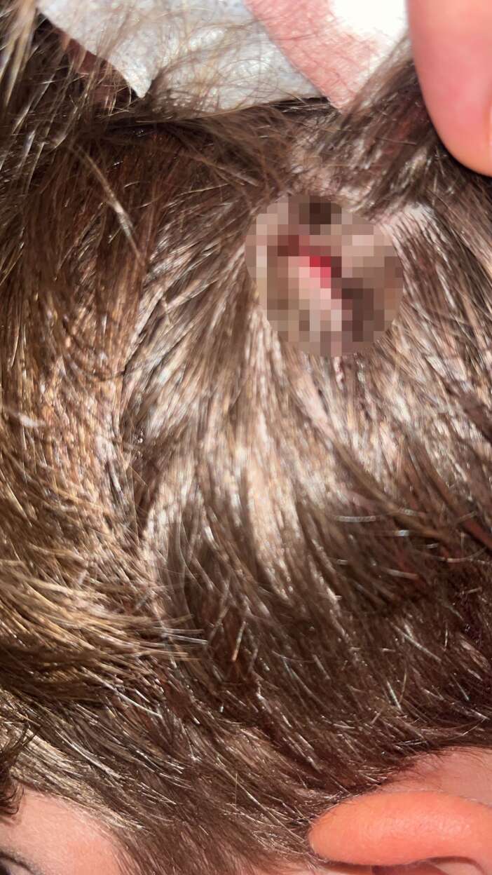 komsu-kavgasinda-kizinin-ardindan-oglu-da-saldiriya-ugradi