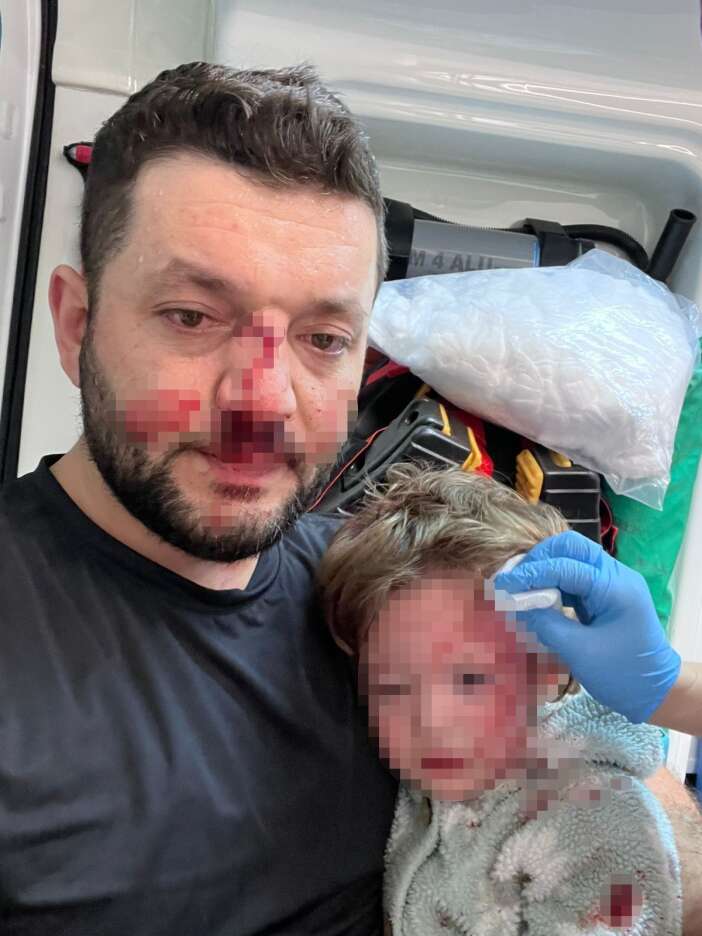 komsu-kavgasinda-kizinin-ardindan-oglu-da-saldiriya-ugradi