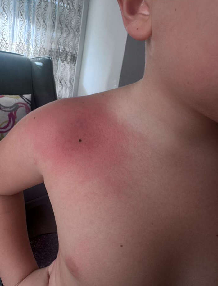 ogretmen-hakkinda-vahim-iddia-cocugun-vucudunu-goren-anne-sikayetci-oldu