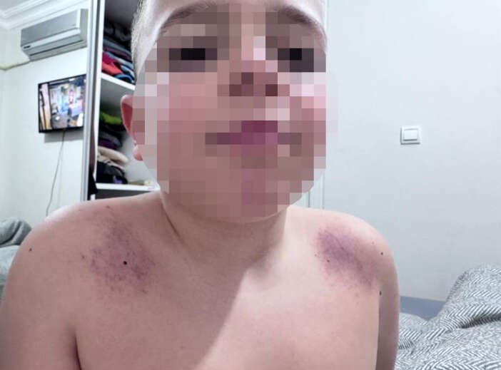 ogretmen-hakkinda-vahim-iddia-cocugun-vucudunu-goren-anne-sikayetci-oldu