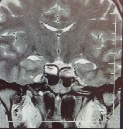 hamileyim-diye-gittigi-hastanede-korkunc-gercekle-yuzlesti