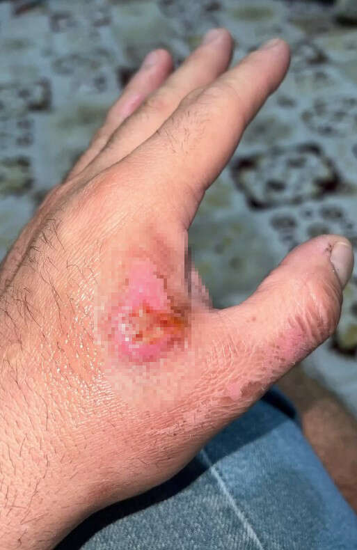 konyali-sosyal-medya-fenomeni-baca-temizlerken-kendini-yakti