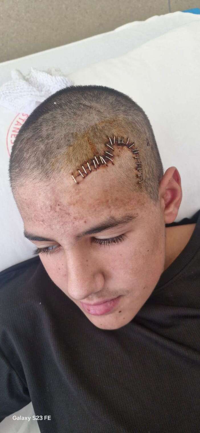 konyada-arkadasinin-kafasini-kiran-cocugun-savunmasi-pes-dedirtti