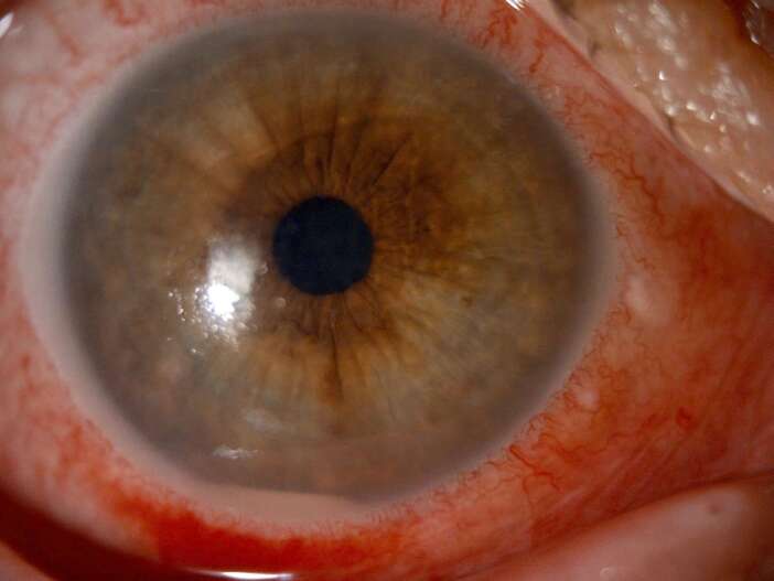 gozune-damlattigi-kirlangic-otu-az-kalsin-kor-ediyordu