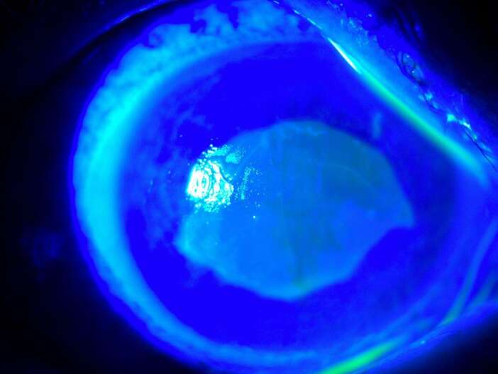 gozune-damlattigi-kirlangic-otu-az-kalsin-kor-ediyordu