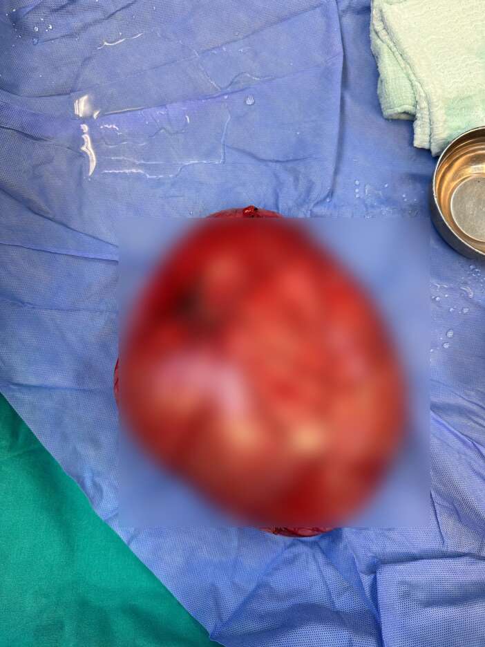 14-yasindaki-kiz-kilo-aldigi-sandi-gercek-ultrasonda-ortaya-cikti