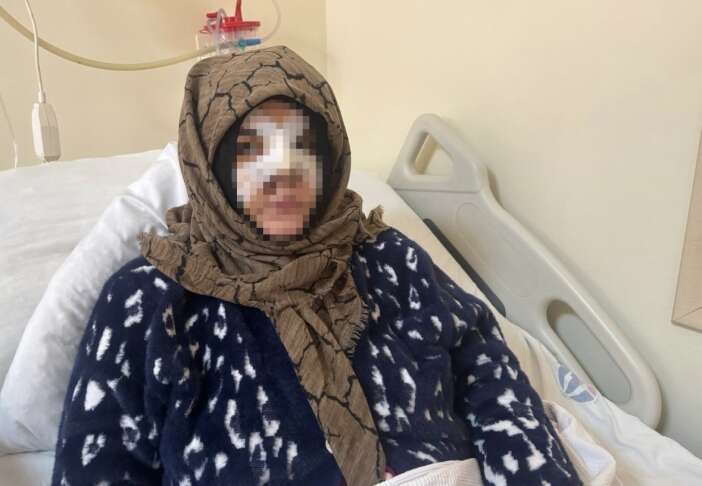 esinin-yuzunu-tasla-ezen-adam-hakkinda-yeni-karar