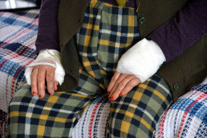 komsusu-yasli-kadina-dehseti-yasatti-ellerini-kesip-bileziklerini-caldi