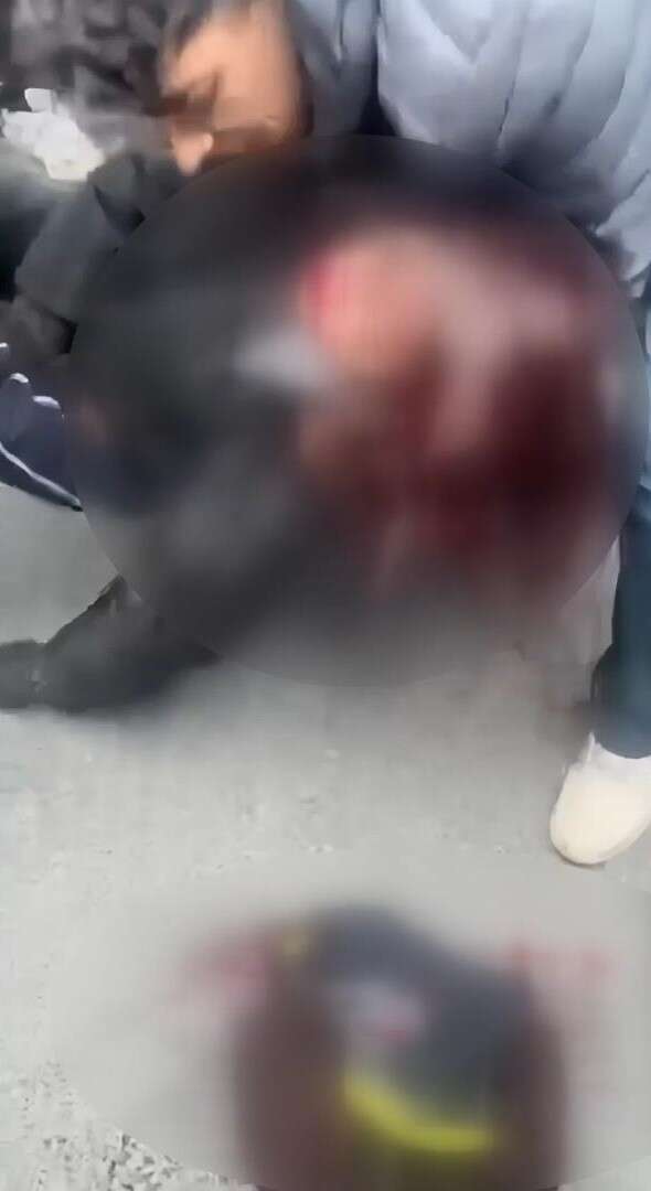 kaza-yapan-ehliyetsiz-surucu-yarali-kiz-arkadasini-birakip-kacti