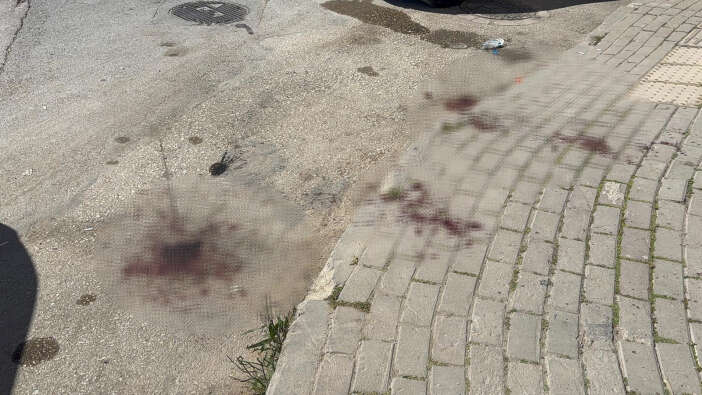 sosyal-medya-fenomeni-karagul-canli-yayinda-birini-bicakladi