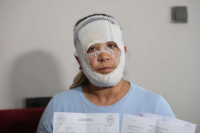 gittigi-guzellik-merkezinde-yuzu-yandi