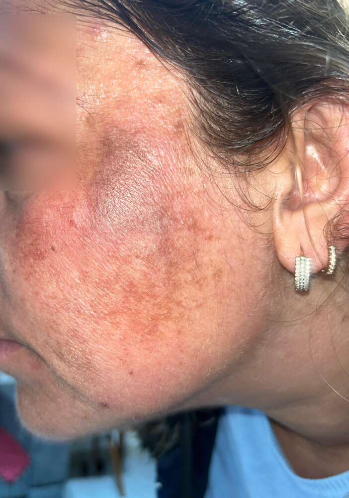 gittigi-guzellik-merkezinde-yuzu-yandi