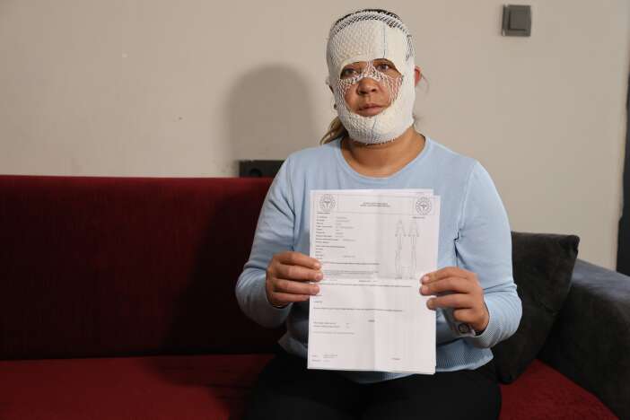 gittigi-guzellik-merkezinde-yuzu-yandi