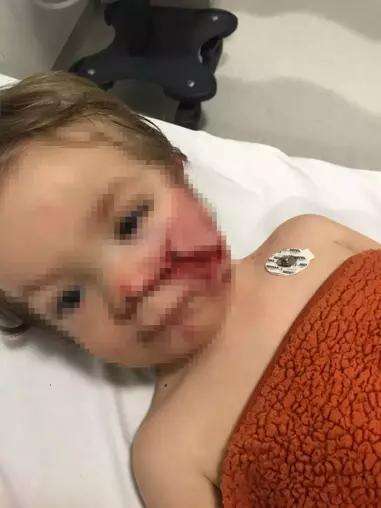 pitbull-cinsi-kopek-1