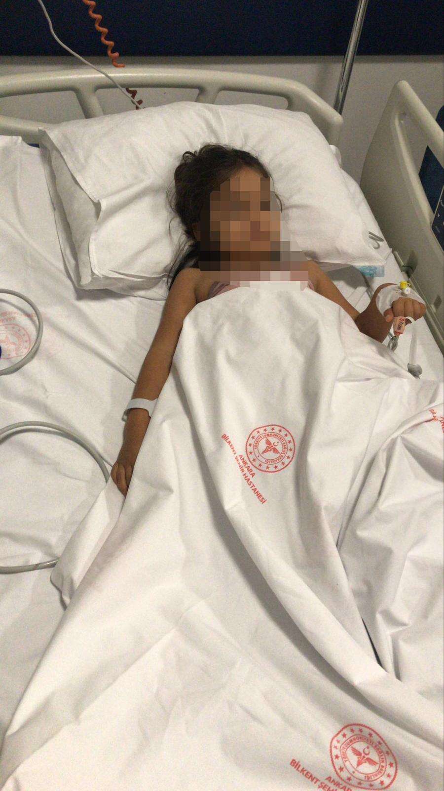 pitbull-cinsi-kopek-1