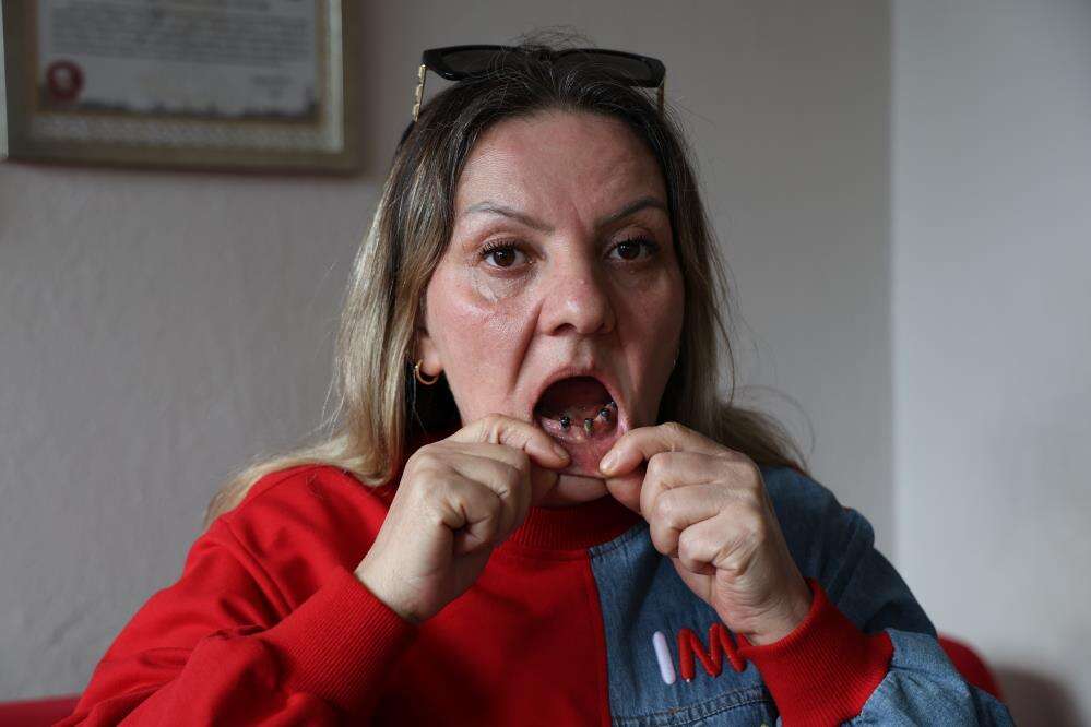 dis-agrisiyla-hastaneye-gitti-hayati-kabusa-dondu-25-disi-birden-cekildi