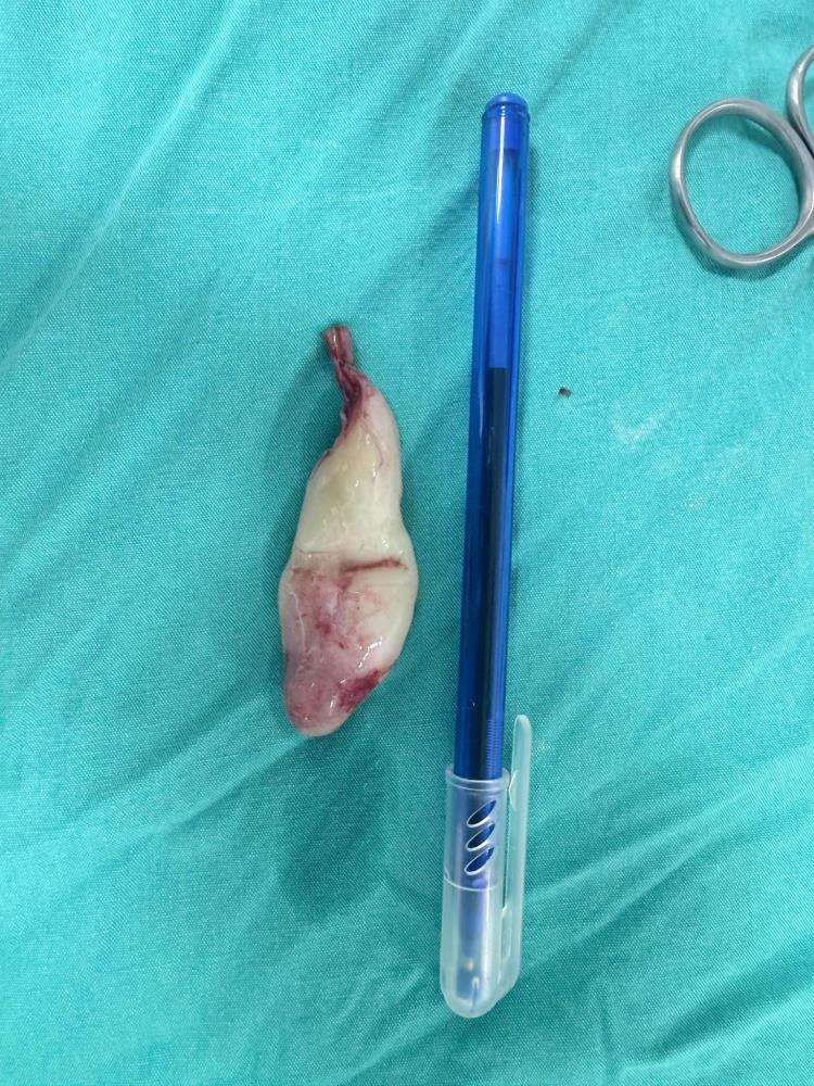 burun-tikanikligi-sikayetiyle-hastaneye-gitti-gercek-bambaska-cikti