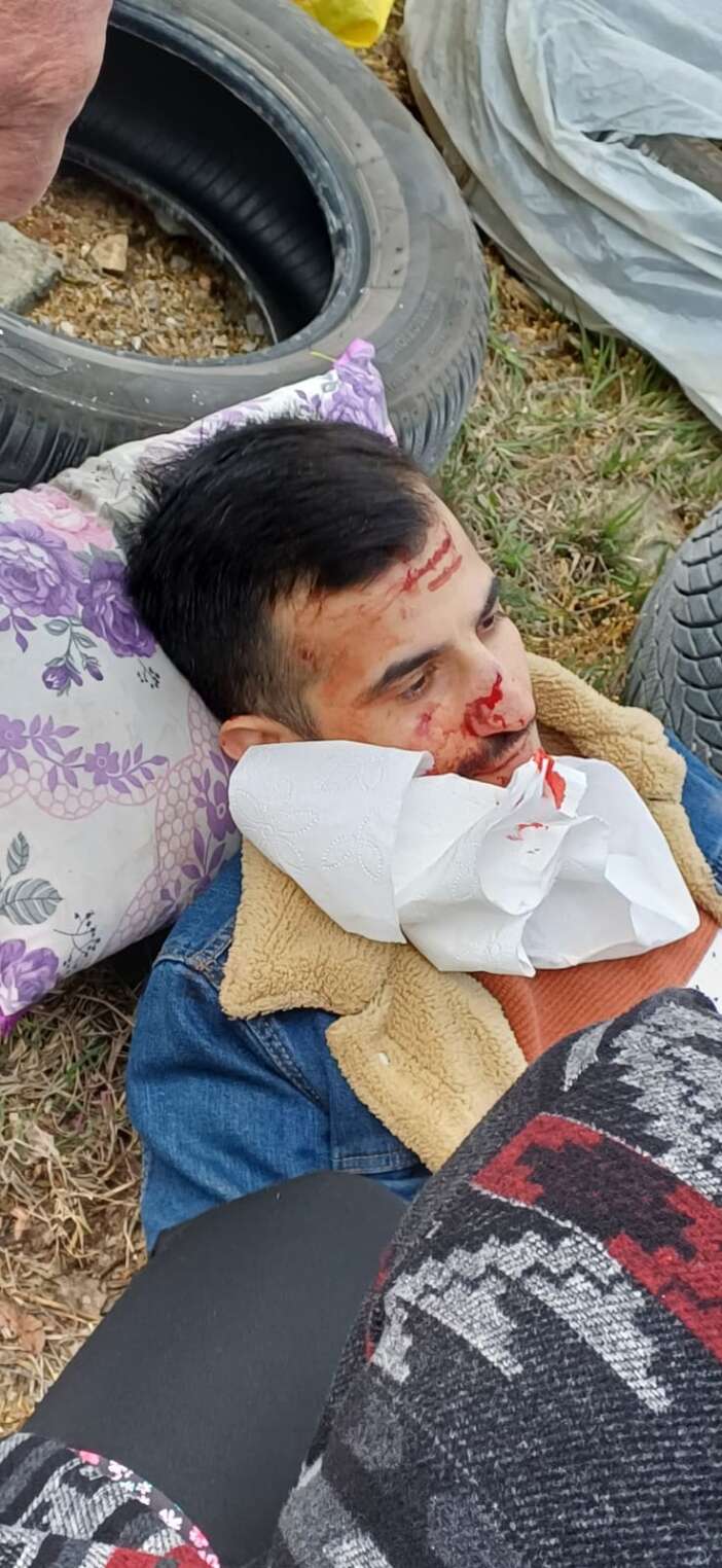 konyada-kontrolden-cikan-arac-refuje-devrildi-3-yarali-var