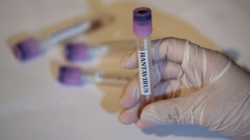 hantavirus-nedir-nasil-bulasir