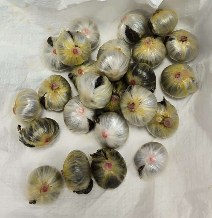 polis-durdurdu-midesinden-uyusturucu-cikti