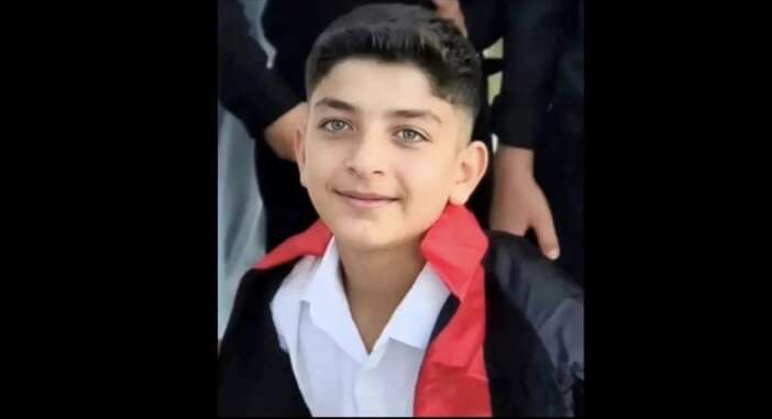 oto-tamircide-patlama-13-yasindaki-cirak-hayatini-kaybetti