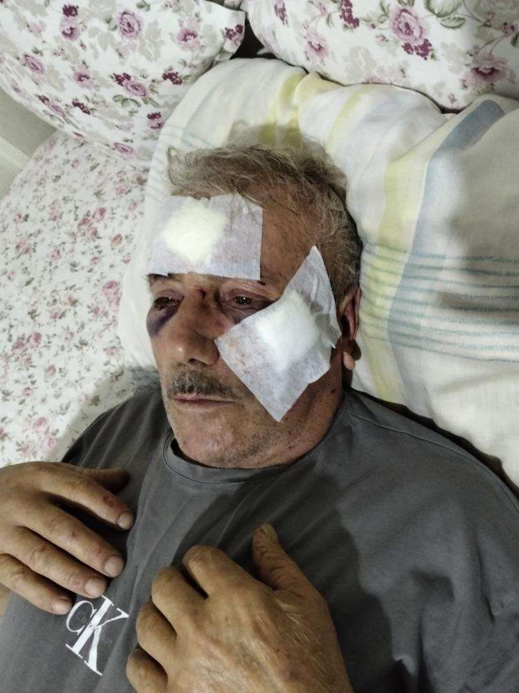 ogretmen-yasli-adami-mustayla-darp-etti-sebebi-de-olay-kadar-vahim