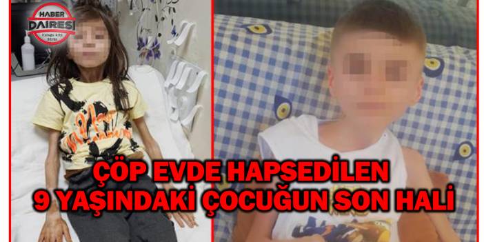 Çöp eve hapsedilen 9 yaşındaki çocuğun son hali